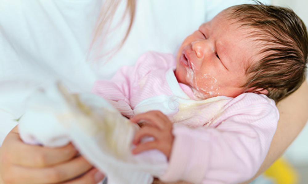 How To Prevent Reflux In Babies? Managing Infant Reflux