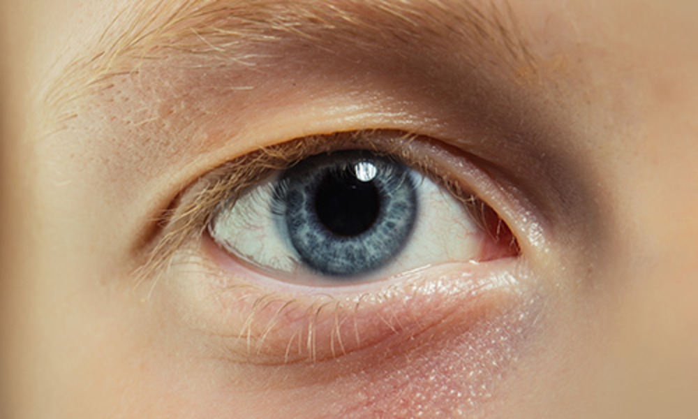 Treatments for Pink Eye in Babies and Toddlers