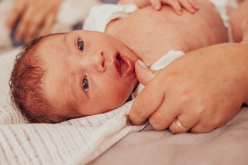 Identifying Tongue-Tie in Babies
