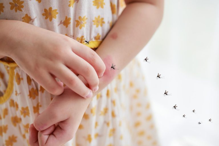 How To Treat Mosquito Bites On Babies? Bites On Infants
