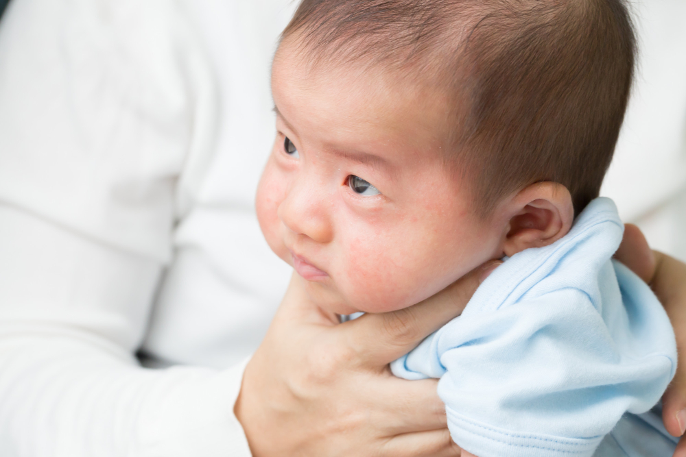 How To Treat Croup In Babies: Causes, Symptoms, and Remedies