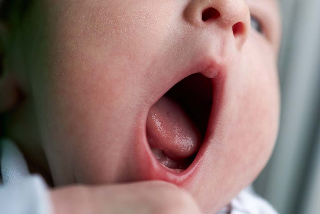 Common Problems Associated with Cleaning a Baby’s Tongue
