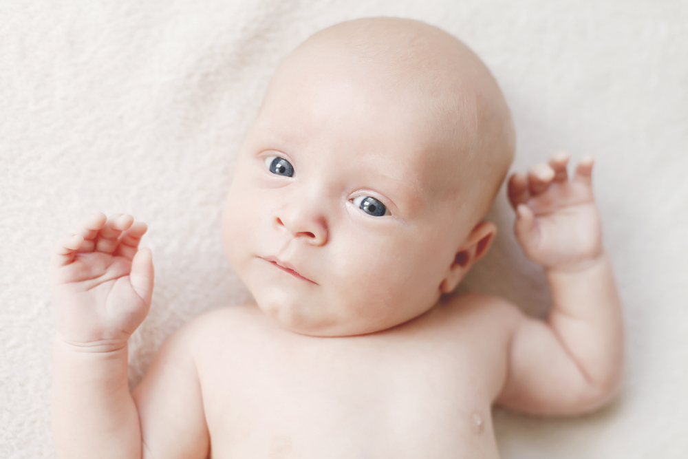 What is Torticollis?
