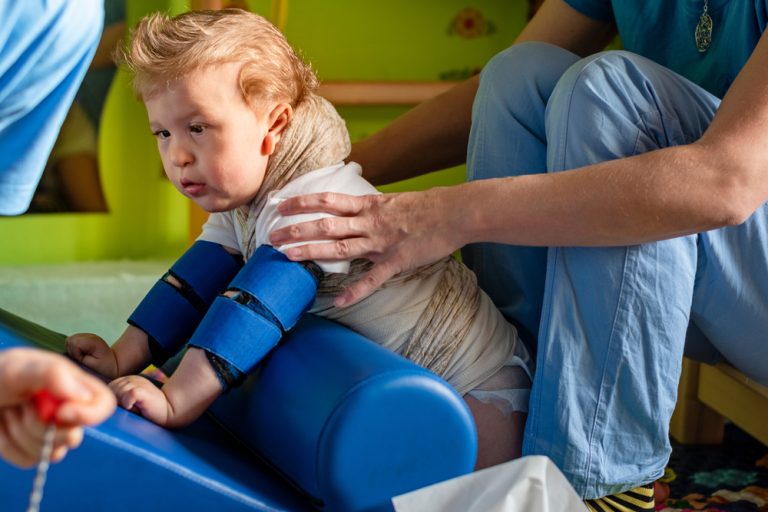 Cerebral Palsy in Babies: Causes, Symptoms, and Treatment