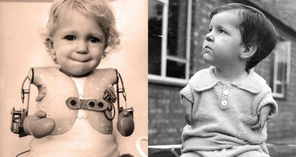 Understanding Thalidomide’s Impact on Babies